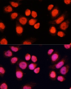 CHAMP1 Antibody