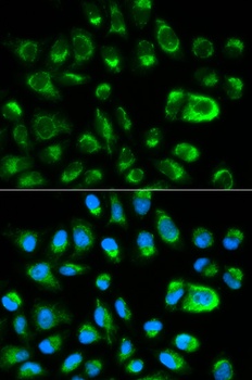 GAS2 Antibody