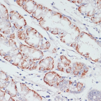 ACSL3 Antibody