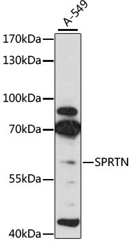 SPRTN Antibody
