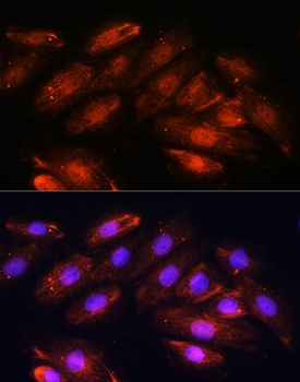 OTUB1 Antibody