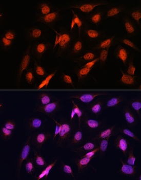 OTUB1 Antibody