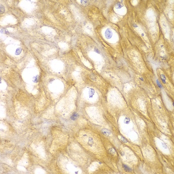 ACTN1 Antibody