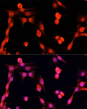 EGFR Antibody