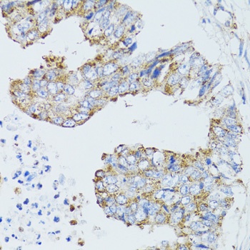 EGFR Antibody