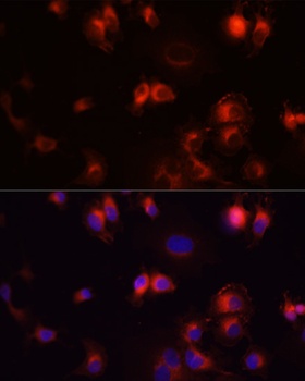 EGFR Antibody