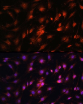 BRCA1 Antibody