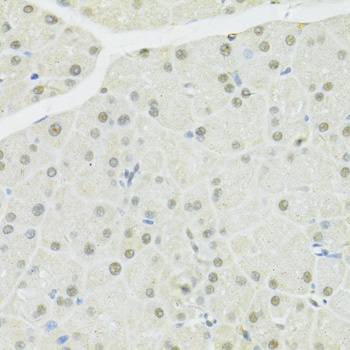 BRCA1 Antibody