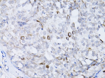 BRCA1 Antibody