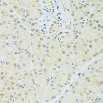 BRCA1 Antibody
