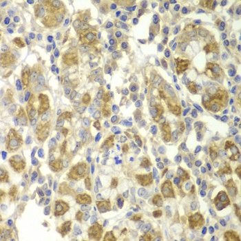 TNF Antibody