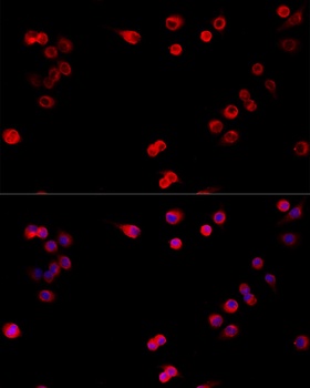 TNF-α Antibody