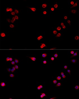 TNF Antibody