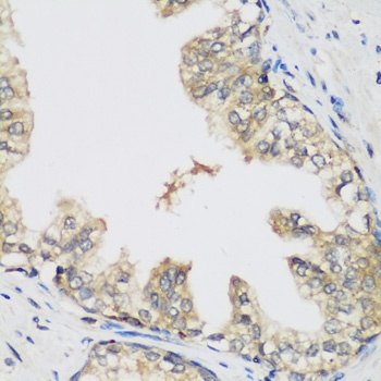 RRM1 Antibody