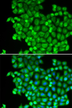 LDHA Antibody