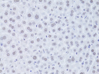 CDKN1A Antibody