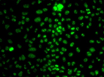 Ki67 Antibody