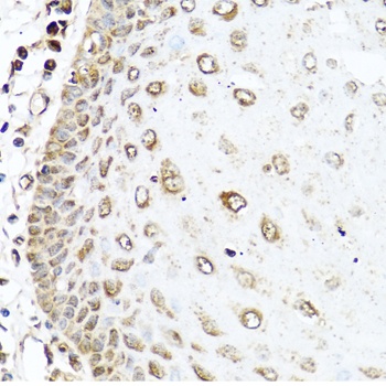 RAC2 Antibody