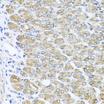 RAC2 Antibody