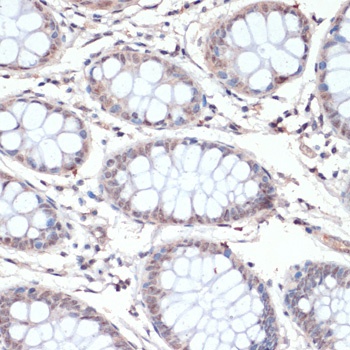 c-Jun Antibody