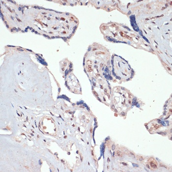 Jun Antibody