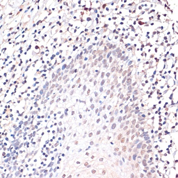 c-Jun Antibody