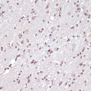 Jun Antibody