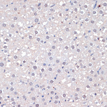 Jun Antibody