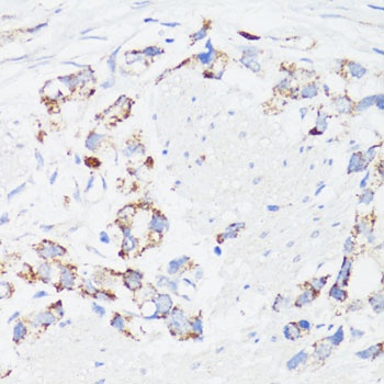 EGFR Antibody