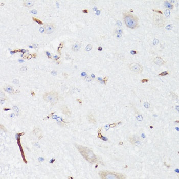 EGFR Antibody