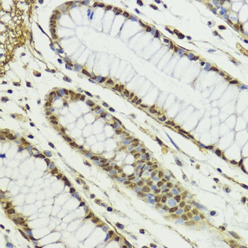 CTCF Antibody