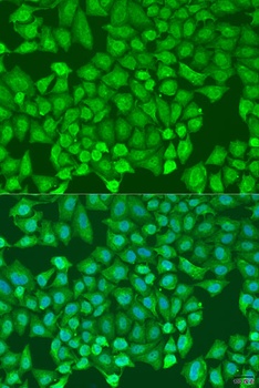 CTCF Antibody