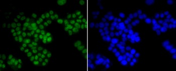 CTCF Antibody