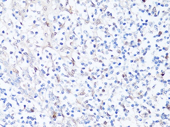 SQSTM1 / p62 Antibody