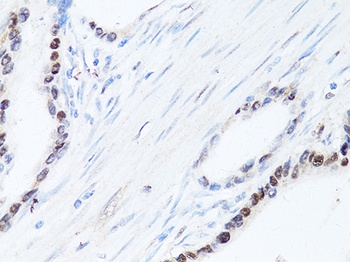 SQSTM1 / p62 Antibody