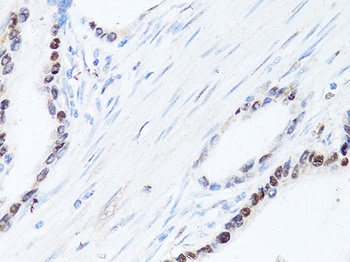 SQSTM1 Antibody