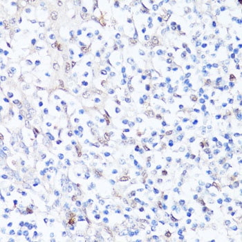 SQSTM1 Antibody
