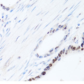 SQSTM1 / p62 Antibody