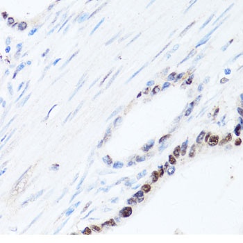 SQSTM1 Antibody