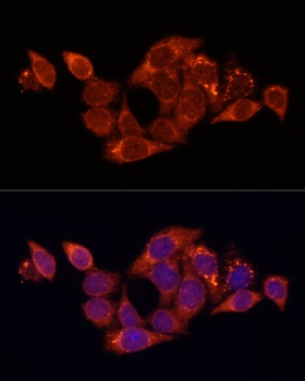 SQSTM1 / p62 Antibody