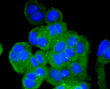 SQSTM1 / p62 Antibody