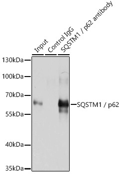 SQSTM1 / p62 Antibody
