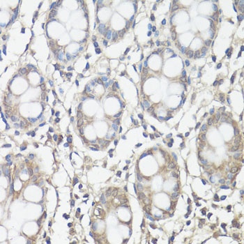 FAK Antibody