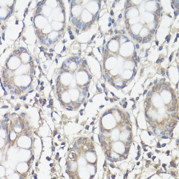 PTK2 Antibody