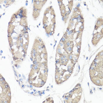 FAK Antibody