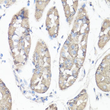 PTK2 Antibody