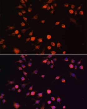 FAK Antibody