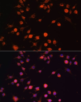 PTK2 Antibody