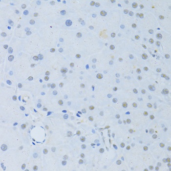 FAK Antibody