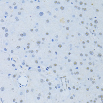 PTK2 Antibody